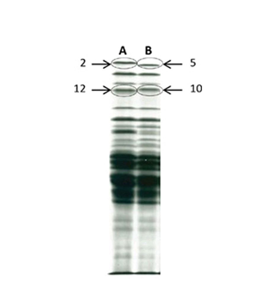 ساختار گلوتنین